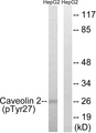 CAV2 / Caveolin 2 Antibody - Western blot analysis of lysates from HepG2 cells treated with EGF 200ng/ml 5' , using Caveolin 2 (Phospho-Tyr27) Antibody. The lane on the right is blocked with the phospho peptide.