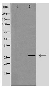 CAV2 / Caveolin 2 Antibody - Western blot of Caveolin 2 (Phospho-Tyr27) expression in Human fetal lung lysate
