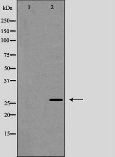 CAV2 / Caveolin 2 Antibody - Western blot analysis of Caveolin 2 (Phospho-Tyr27) expression in human fetal lung lysate. The lane on the left is treated with the antigen-specific peptide.