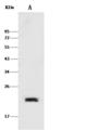 CAV2 / Caveolin 2 Antibody - Anti-CAV2 rabbit polyclonal antibody at 1:500 dilution. Lane A: A431 Whole Cell Lysate. Lysates/proteins at 30 ug per lane. Secondary: Goat Anti-Rabbit IgG (H+L)/HRP at 1/10000 dilution. Developed using the ECL technique. Performed under reducing conditions. Predicted band size: 18 kDa. Observed band size: 20 kDa.