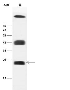 CAV2 / Caveolin 2 Antibody - Anti-CAV2 rabbit polyclonal antibody at 1:1000 dilution. Lane A: Mouse lung tissue lysate. Lysates/proteins at 30 ug per lane. Secondary: Goat Anti-Rabbit IgG (H+L)/HRP at 1/10000 dilution. Developed using the ECL technique. Performed under reducing conditions. Predicted band size: 18 kDa. Observed band size: 24 kDa. (We are unsure as to the identity of these extra bands.)