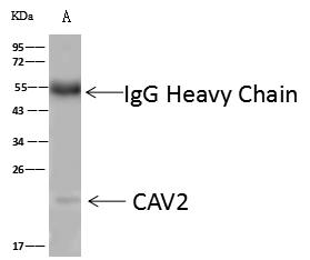 CAV2 / Caveolin 2 Antibody - CAV2 was immunoprecipitated using: Lane A: 0.5 mg Mouse lung tissue lysate. 4 uL anti-CAV2 rabbit polyclonal antibody and 60 ug of Immunomagnetic beads Protein A/G. Primary antibody: Anti-CAV2 rabbit polyclonal antibody, at 1:100 dilution. Secondary antibody: Goat Anti-Rabbit IgG (H+L)/HRP at 1/10000 dilution. Developed using the ECL technique. Performed under reducing conditions. Predicted band size: 18 kDa. Observed band size: 22 kDa.