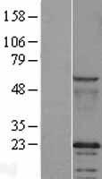 CAV2 / Caveolin 2 Protein - Western validation with an anti-DDK antibody * L: Control HEK293 lysate R: Over-expression lysate