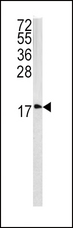 CAV3 / Caveolin 3 Antibody - Western blot of CAV3 antibody in 293 cell line lysates (35 ug/lane). CAV3 (arrow) was detected using the purified antibody.