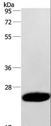 CAV3 / Caveolin 3 Antibody - Western blot analysis of Human fetal muscle tissue, using CAV3 Polyclonal Antibody at dilution of 1:500.