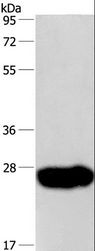 CAV3 / Caveolin 3 Antibody - Western blot analysis of Human fetal muscle tissue, using CAV3 Polyclonal Antibody at dilution of 1:550.
