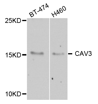 CAV3 / Caveolin 3 Antibody - Western blot analysis of extract of various cells.