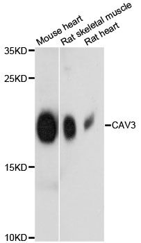CAV3 / Caveolin 3 Antibody - Western blot analysis of extracts of various cell lines, using CAV3 antibody at 1:3000 dilution. The secondary antibody used was an HRP Goat Anti-Rabbit IgG (H+L) at 1:10000 dilution. Lysates were loaded 25ug per lane and 3% nonfat dry milk in TBST was used for blocking. An ECL Kit was used for detection and the exposure time was 90s.