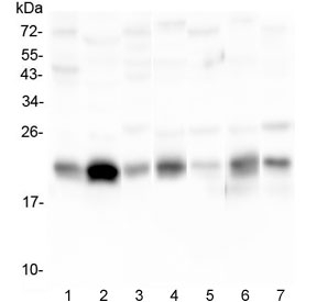 CAV3 / Caveolin 3 Antibody - Western blot testing of 1) human placenta, 2) U-87 MG, 3) human HeLa, 4) rat stomach, 5) rat testis, 6) mouse stomach and 7) mouse testis lysate with Caveolin-3 antibody at 0.5ug/ml. Predicted molecular weight: ~17 kDa but routinely observed at 20~25 kDa.