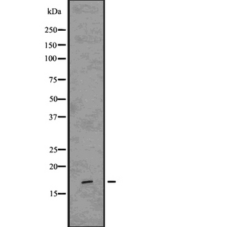 CAV3 / Caveolin 3 Antibody - Western blot analysis of Caveolin 3 using HepG2 whole cells lysates