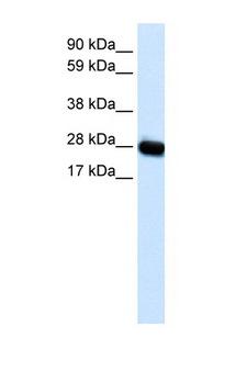 CAV3 / Caveolin 3 Antibody - CAV3 / Caveolin 3 antibody Western blot of Fetal muscle lysate. Antibody concentration 1 ug/ml. This image was taken for the unconjugated form of this product. Other forms have not been tested.