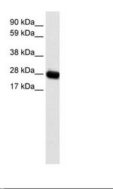 CAV3 / Caveolin 3 Antibody - Fetal muscle Lysate.  This image was taken for the unconjugated form of this product. Other forms have not been tested.