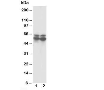 CBFA1 / RUNX2 Antibody - Western blot testing of RUNX2 antibody and Lane 1: rat thymus; 2: rat testis tissue lysate