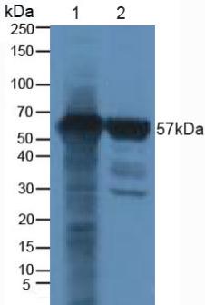 CBFA1 / RUNX2 Antibody - Western Blot; Sample: Lane1: Human Cartilage Tissue; Lane2: Human Liver Tissue.