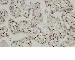 CBFA1 / RUNX2 Antibody - IHC of RUNX-2 (D198) pAb in paraffin-embedded human placenta tissue.