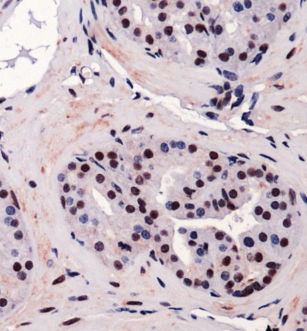 CBFA1 / RUNX2 Antibody - Immunohistochemistry: RUNX2 Antibody - Staining of RUNX2 in mouse prostate using DAB with hematoxylin counterstain.  This image was taken for the unconjugated form of this product. Other forms have not been tested.