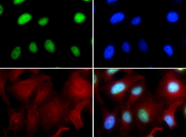 CBFA1 / RUNX2 Antibody - Immunocytochemistry/Immunofluorescence: RUNX2 Antibody - RUNX2 antibody was tested in HeLa cells with FITC (green). Nuclei and alpha-tubulin were counterstained with Dapi (blue) and Dylight 594 (red).  This image was taken for the unconjugated form of this product. Other forms have not been tested.