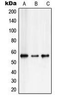 CBFA1 / RUNX2 Antibody - Western blot analysis of RUNX2 expression in Saos2 (A); HepG2 (B); Jurkat (C) whole cell lysates.