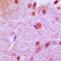 CBFA1 / RUNX2 Antibody - Immunohistochemical analysis of RUNX2 staining in human brain formalin fixed paraffin embedded tissue section. The section was pre-treated using heat mediated antigen retrieval with sodium citrate buffer (pH 6.0). The section was then incubated with the antibody at room temperature and detected using an HRP conjugated compact polymer system. DAB was used as the chromogen. The section was then counterstained with hematoxylin and mounted with DPX.