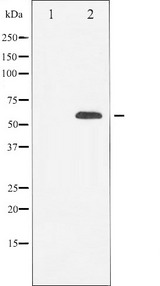 CBFA1 / RUNX2 Antibody - Western blot analysis of RUNX2 expression in HeLa cells. The lane on the left is treated with the antigen-specific peptide.
