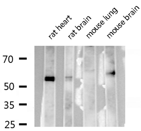 CBFA1 / RUNX2 Antibody - Western blot analysis of RUNX2 expression in various lysates