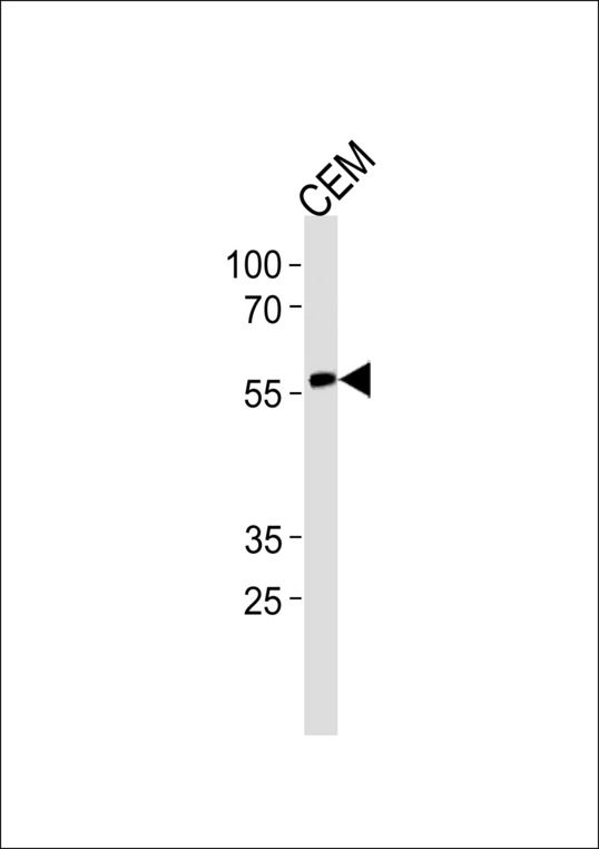 CBFA1 / RUNX2 Antibody - RUNX2 Antibody (S465) western blot of CEM cell line lysates (35 ug/lane). The RUNX2 antibody detected the RUNX2 protein (arrow).