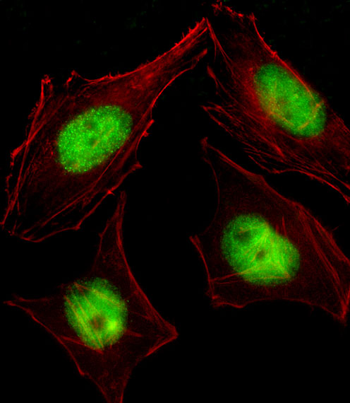 CBFA2T2 / MTGR1 Antibody - Fluorescent image of HeLa cell stained with CBFA2T2 Antibody. HeLa cells were fixed with 4% PFA (20 min), permeabilized with Triton X-100 (0.1%, 10 min), then incubated with CBFA2T2 primary antibody (1:25, 1 h at 37°C). For secondary antibody, Alexa Fluor 488 conjugated donkey anti-rabbit antibody (green) was used (1:400, 50 min at 37°C). Cytoplasmic actin was counterstained with Alexa Fluor 555 (red) conjugated Phalloidin (7units/ml, 1 h at 37°C). CBFA2T2 immunoreactivity is localized to Nucleus significantly.