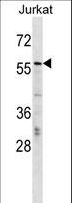 CBFA2T2 / MTGR1 Antibody - CBFA2T2 Antibody western blot of Jurkat cell line lysates (35 ug/lane). The CBFA2T2 antibody detected the CBFA2T2 protein (arrow).