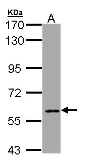 CBFA2T2 / MTGR1 Antibody - Sample (30 ug of whole cell lysate). A: Hep G2 . 7.5% SDS PAGE. MTGR1 antibody diluted at 1:1000.