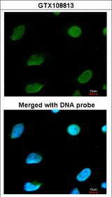 CBFA2T2 / MTGR1 Antibody - Immunofluorescence of paraformaldehyde-fixed HeLa using CBFA2T2 antibody at 1:200 dilution.