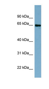 CBFA2T2 / MTGR1 Antibody - CBFA2T2 antibody Western blot of Fetal Thymus lysate. This image was taken for the unconjugated form of this product. Other forms have not been tested.