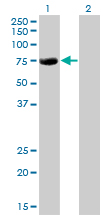 CBFA2T2 / MTGR1 Antibody - Western blot of CBFA2T2 expression in transfected 293T cell line by CBFA2T2 monoclonal antibody (M15), clone 2C10.