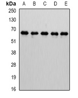CBFA2T2 / MTGR1 Antibody - Western blot analysis of MTGR1 expression in Jurkat (A); HepG2 (B); mouse testis (C); mouse kidney (D); rat brain (E) whole cell lysates.