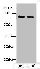 CBFA2T2 / MTGR1 Antibody - Western blot All Lanes: CBFA2T2 antibody at 1.82ug/ml Lane 1: 293T whole cell lysate Lane 2: Raji whole cell lysate Secondary Goat polyclonal to Rabbit IgG at 1/10000 dilution Predicted band size: 68,64,29,66 kDa Observed band size: 67 kDa