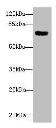 CBFA2T2 / MTGR1 Antibody - Western blot All lanes: CBFA2T2 antibody at 1.82µg/ml + 293T whole cell lysate Secondary Goat polyclonal to rabbit IgG at 1/10000 dilution Predicted band size: 68, 64, 29, 66 kDa Observed band size: 68 kDa