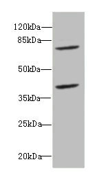 CBFA2T2 / MTGR1 Antibody - Western blot All Lanes: CBFA2T2antibody at 2.45ug/ml+ Raji whole cell lysate Goat polyclonal to rabbit at 1/10000 dilution Predicted band size: 68,64,29,66 kDa Observed band size: 67 kDa,40 kDa