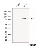 CBFA2T2 / MTGR1 Antibody - Western blot analysis of extracts of HeLa cells using CBFA2T2 antibody. The lane on the left was treated with blocking peptide.