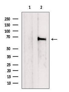 CBFA2T2 / MTGR1 Antibody