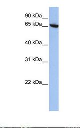 CBFA2T2 / MTGR1 Antibody - HepG2 cell lysate. Antibody concentration: 1.0 ug/ml. Gel concentration: 12%.  This image was taken for the unconjugated form of this product. Other forms have not been tested.