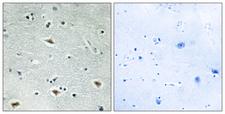 CBFA2T3 Antibody - Immunohistochemistry analysis of paraffin-embedded human brain tissue, using MTG16 Antibody. The picture on the right is blocked with the synthesized peptide.