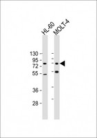CBFA2T3 Antibody - All lanes: Anti-CBFA2T3 Antibody at 1:500-1:2000 dilution Lane 1: HL-60 whole cell lysate Lane 2: MOLT-4 whole cell lysate Lysates/proteins at 20 µg per lane. Secondary Goat Anti-mouse IgG, (H+L), Peroxidase conjugated at 1/10000 dilution. Predicted band size: 71 kDa Blocking/Dilution buffer: 5% NFDM/TBST.