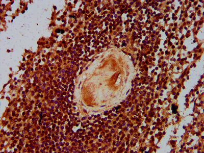 CBFA2T3 Antibody - Immunohistochemistry Dilution at 1:300 and staining in paraffin-embedded human spleen tissue performed on a Leica BondTM system. After dewaxing and hydration, antigen retrieval was mediated by high pressure in a citrate buffer (pH 6.0). Section was blocked with 10% normal Goat serum 30min at RT. Then primary antibody (1% BSA) was incubated at 4°C overnight. The primary is detected by a biotinylated Secondary antibody and visualized using an HRP conjugated SP system.