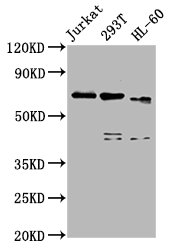 CBFA2T3 Antibody - Western Blot Positive WB detected in: Jurkat whole cell lysate, 293T whole cell lysate, HL-60 whole cell lysate All Lanes: CBFA2T3 antibody at 5µg/ml Secondary Goat polyclonal to rabbit IgG at 1/50000 dilution Predicted band size: 72, 63, 64, 8 KDa Observed band size: 72 KDa