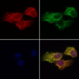 CBFA2T3 Antibody - Staining HeLa cells by IF/ICC. The samples were fixed with PFA and permeabilized in 0.1% Triton X-100, then blocked in 10% serum for 45 min at 25°C. Samples were then incubated with primary Ab(1:200) and mouse anti-beta tubulin Ab(1:200) for 1 hour at 37°C. An AlexaFluor594 conjugated goat anti-rabbit IgG(H+L) Ab(1:200 Red) and an AlexaFluor488 conjugated goat anti-mouse IgG(H+L) Ab(1:600 Green) were used as the secondary antibod