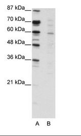 CBFA2T3 Antibody - A: Marker, B: Jurkat Cell Lysate.  This image was taken for the unconjugated form of this product. Other forms have not been tested.