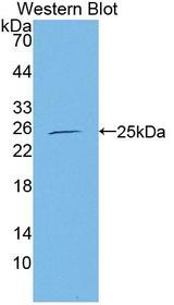 CBFB Antibody - Western blot of CBFB antibody.