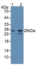 CBFB Antibody - Western Blot; Sample: Lane1: Human K562 Cells; Lane2: Human Jurkat Cells.