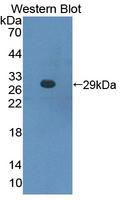 CBFB Antibody - Western blot of CBFB antibody.