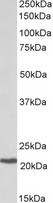 CBFB Antibody - CBFB antibody (0.3 ug/ml) staining of Daudi lysate (35 ug protein in RIPA buffer). Primary incubation was 1 hour. Detected by chemiluminescence.