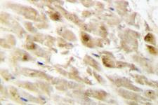 CBFB Antibody - IHC of PEBP2 (R33) pAb in paraffin-embedded human heart tissue.